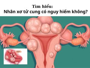 Nhân xơ tử cung có nguy hiểm không