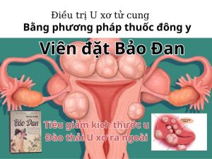 Chữa u xơ tử cung bằng đông y
