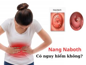 Nang naboth có nguy hiểm không?