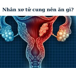 nhân xơ tử cung nên ăn gì
