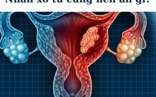 nhân xơ tử cung nên ăn gì