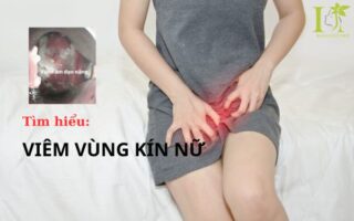 Viêm vùng kín nữ