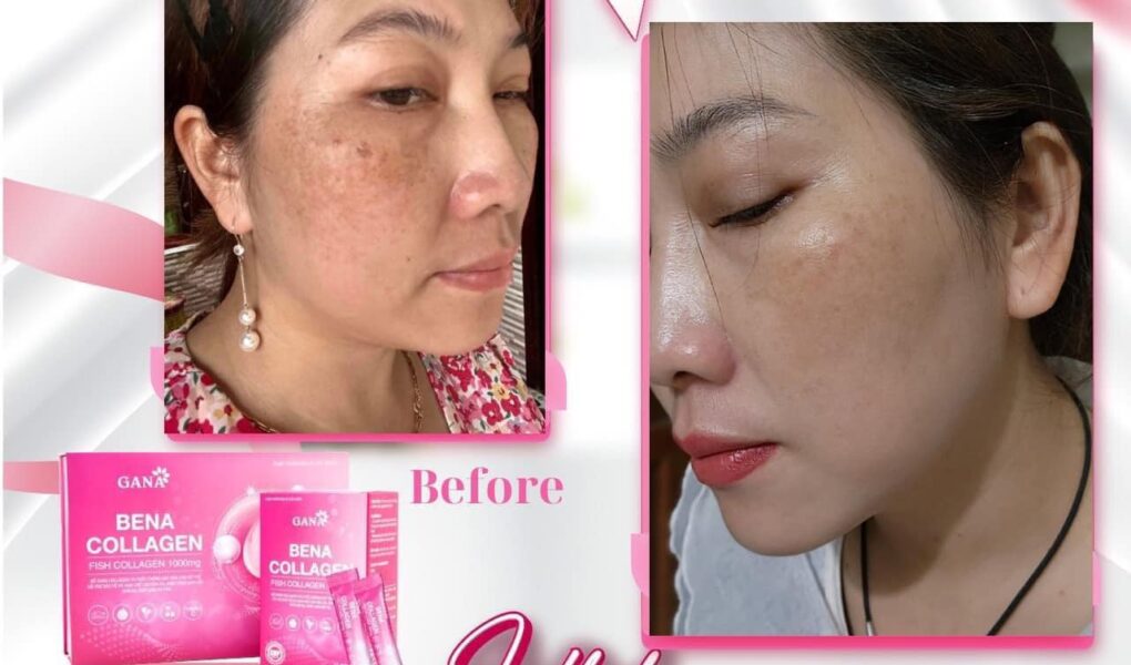 Collagen bena
