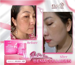 Collagen bena