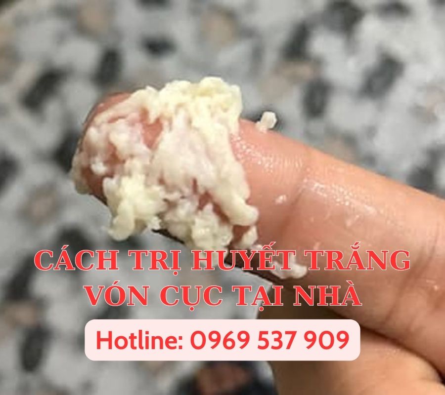 CÁCH TRỊ HUYẾT TRẮNG VÓN CỤC TẠI NHÀ