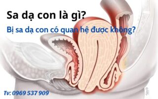 Bị sa dạ con có quan hệ được không?