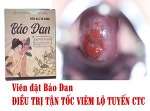 Thuốc đông y chữa viêm lộ tuyến