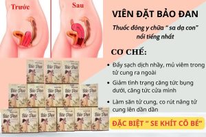 thuốc chữa sa dạ con tại nhà