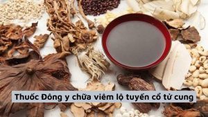 Chữa viêm lộ tuyến bằng dân gian