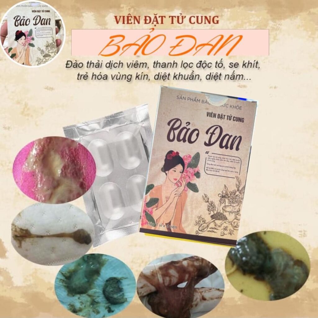 Cách trị huyết trắng vón cục tại nhà