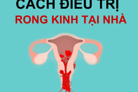 CÁCH ĐIỀU TRỊ RONG KINH TẠI NHÀ