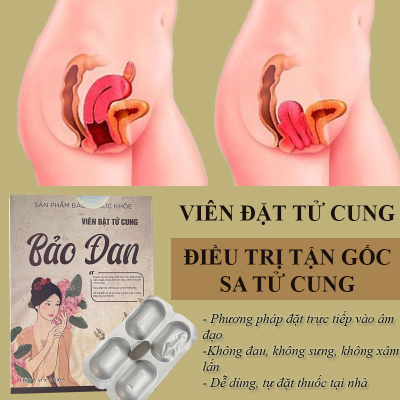 Bệnh sa thành âm đạo