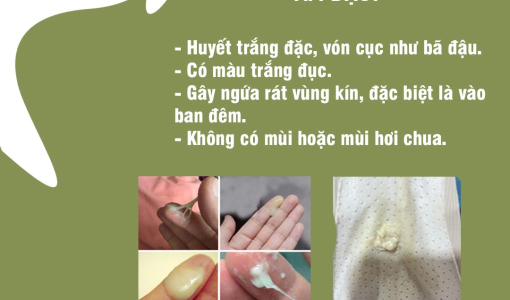 huyết trắng đặc sệt