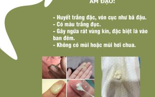 huyết trắng đặc sệt