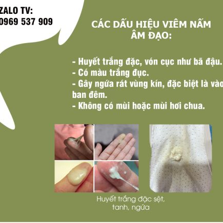 huyết trắng đặc sệt