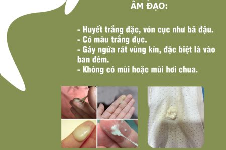 huyết trắng đặc sệt