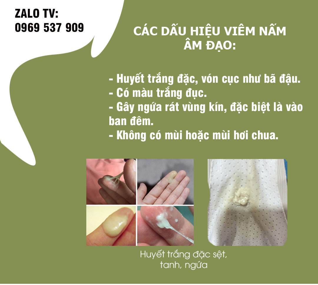 huyết trắng đặc sệt